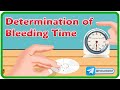 Determination Of Bleeding Time (Duke's Method) Animation : Physiology Practical's