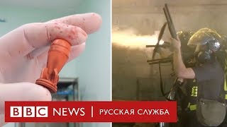 Истории пострадавших от резиновых пуль в Тбилиси [ENG SUBS]