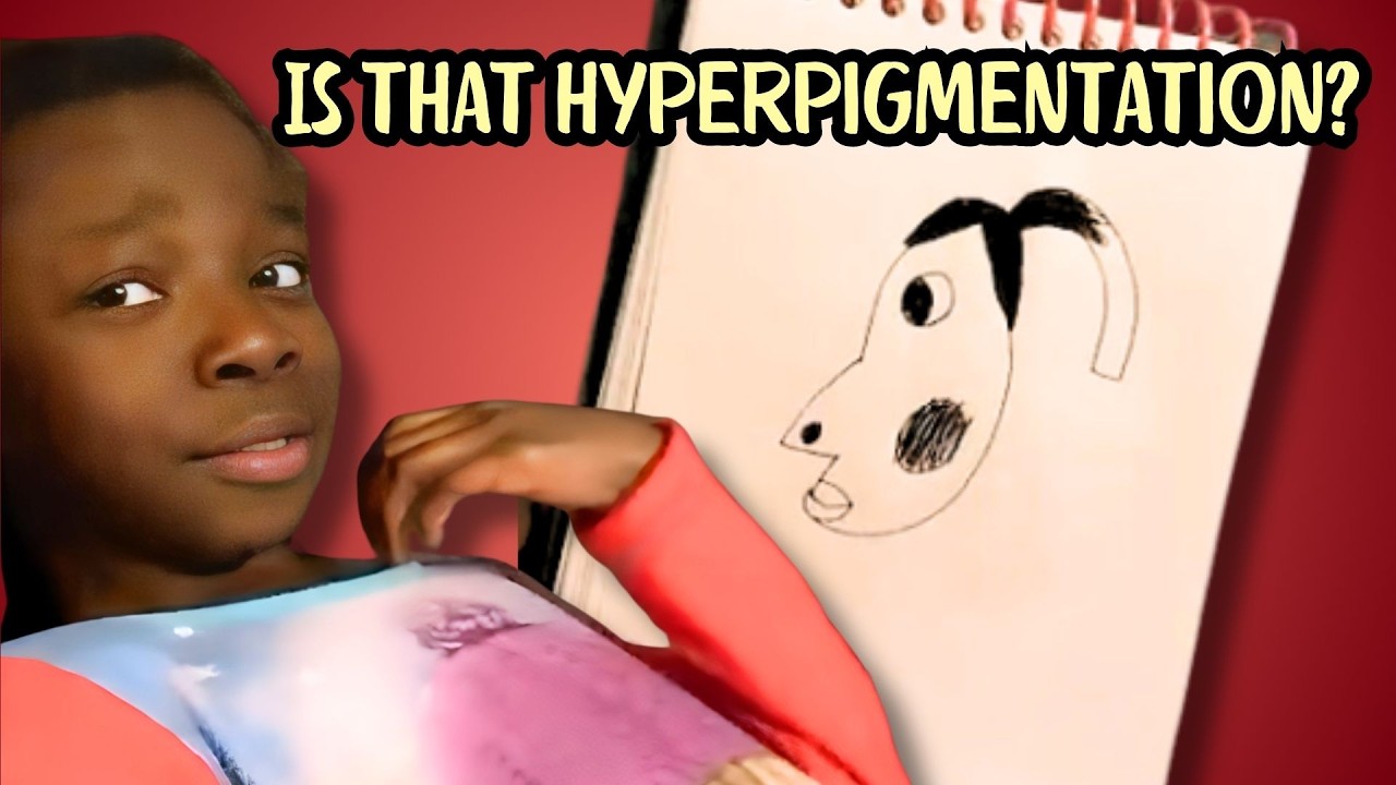 Understanding The Hyperpigmentation Drawing Meme Youtube