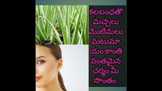 aloevera face pack|కలబంధతొ ఇలా  facepack వేసుకుంటే  కాంతివంతమైన చర్మం మీ సొంతం మచ్చలు మొటిమలు మటుమయం