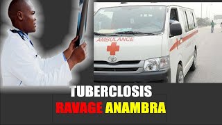 Unbelievable: Anambra's Shocking Childhood TB Statistics Revealed