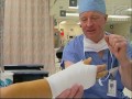 carpal tunnel syndrome uw medicine