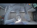 the phillips azurion biplane cath lab film at ruby hall clinic pune