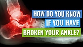 How Do you Know Whether you Have Broken your Ankle?