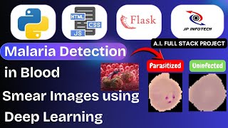 Malaria Detection in Blood Smear Images using Deep Learning | Python Machine Learning IEEE Project