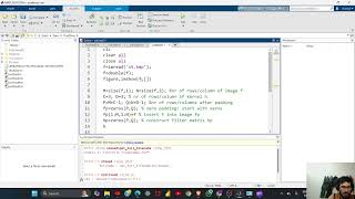Image Sharpening using Laplacian Filter | Matlab Code