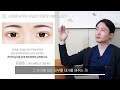 쌍꺼풀 재수술은 보통 어떤 경우에 하나요 ｜쌍꺼풀재수술 1