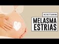 CUIDADOS com a PELE na GRAVIDEZ | MELASMA, ESTRIAS, ACNE, VARIZES com Dra Cintia Cunha