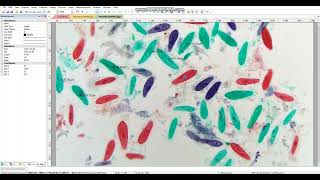 ImageView Microscope Camera Software: Reports