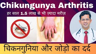 चिकनगुनिया और जोड़ो का दर्द | Chikungunya Arthritis | Chikungunya Fever