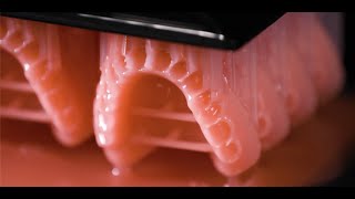 Prótesis dentales 3D Buba