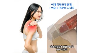 회전근개 봉합과 PRP의 시너지