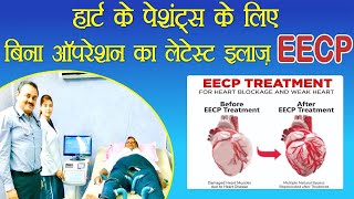 NonSurgical Heart Treatment EECP for Blockage \u0026 Weak Heart … Best Results in Dr Anupam’s Heart Care