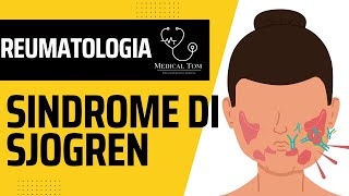 Sindrome di Sjögren | Generalità, Fisiopatologia, Diagnosi e Trattamento