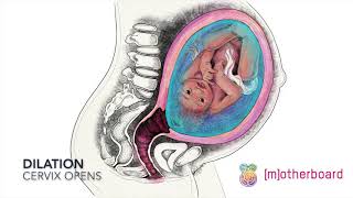 Effacement and Dilation