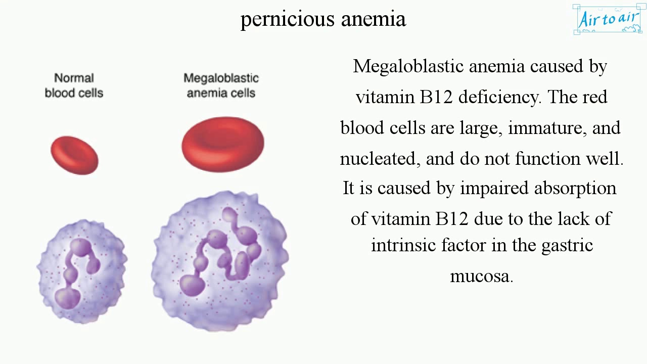 Pernicious Anemia (English) - Medical Terminology For Medical Students - - YouTube