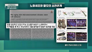 이건 아니지👿 '탈모'까지 유발하는 노화세포 다큐 플러스(docuplus) 185회 | JTBC 211010 방송