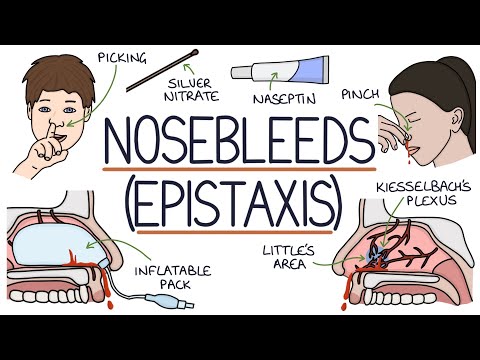 What are three types of nosebleeds?