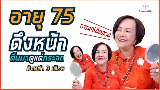 อายุ75ปี หลังดึงหน้ามา ตื่นมาส่องกระจกทุกเช้า ธีรพรคลินิก หมอชลธิศ