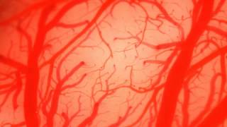 Blood vessel in the brain -脳血管-