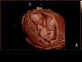 14 week baby moving during 4d ultrasound with hd technology