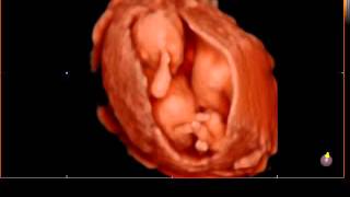 14 Week baby moving during 4D ultrasound with HD technology