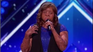 Meet Kechi: Plane-crash Survivor Fights Back Through Singing | Auditions | America’s Got Talent 2017