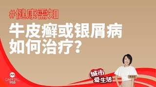 CAPITAL 958 | 健康需知：牛皮癣或银屑病如何治疗？