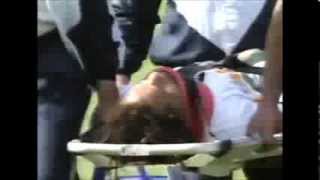 Max Brito paralysed at the bottom of a ruck vs Tonga 1995