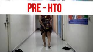 Analysis of gait improvement after HTO