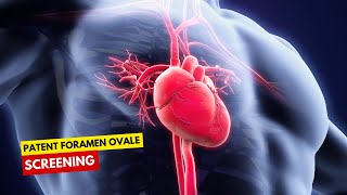 Patent Foramen Ovale Screening