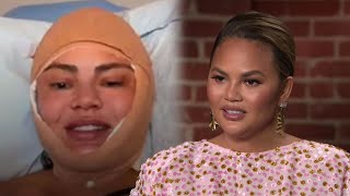 Chrissy Teigen Makes SURPRISING Plastic Surgery Reveal