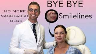 GET RID OF SMILE LINES | DR. KONSTANTIN