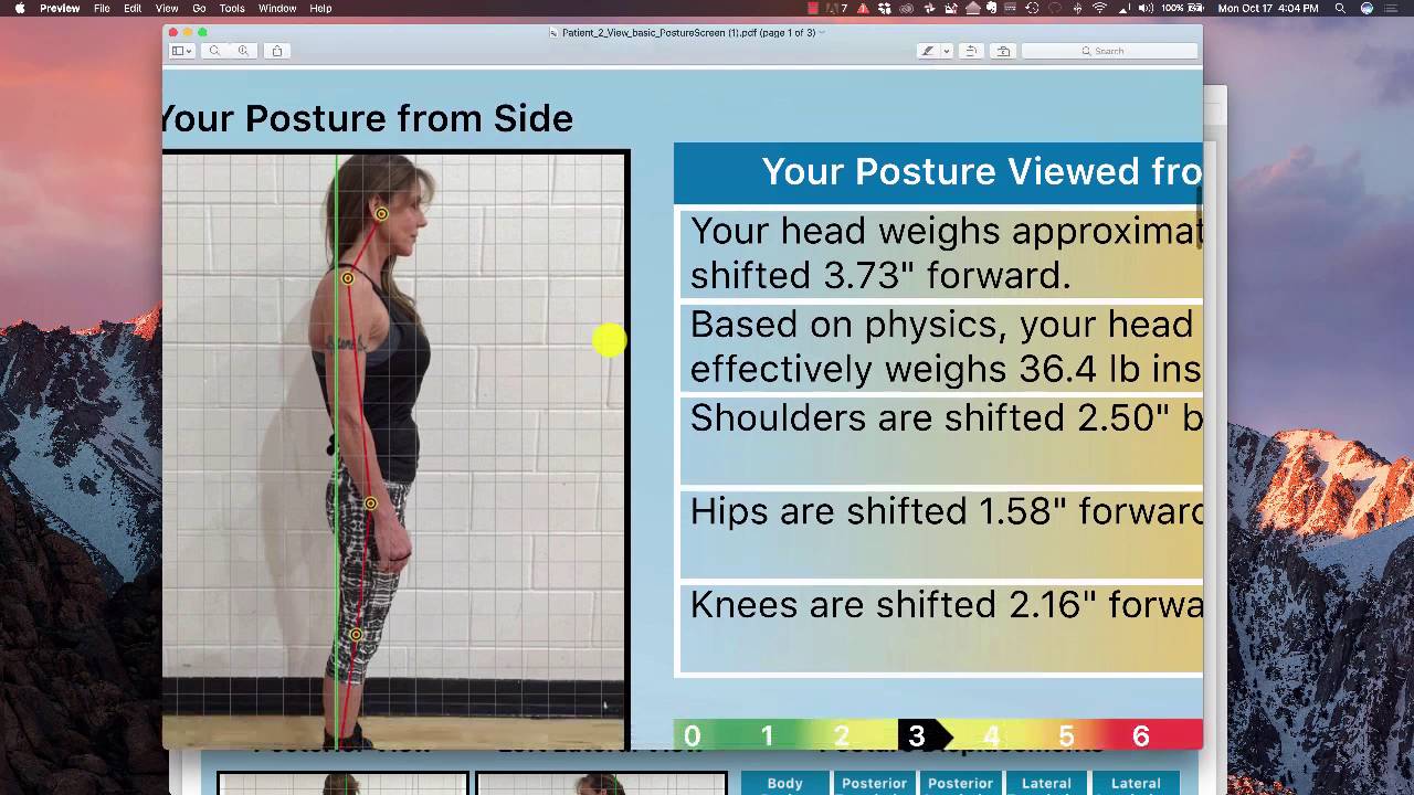 Posturescreen Report Interpretation Youtube