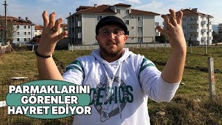 Parmaklarını İlginç Şekillere Sokan Genç Şaşkına Çeviriyor