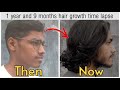 My 1 year & 9 months (21 months) Hair growth time-lapse - (Not 