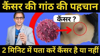 कैंसर की गांठ और नॉर्मल गांठ को कैसे पहचाने | cancer ke lakshan in hindi