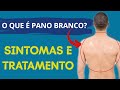 O que é “Pano Branco”? Sintomas e tratamento