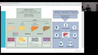 Hepatic Steatosis: NASH vs NAFLD vs MAFLD