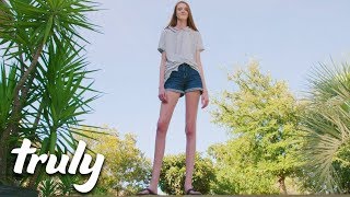 I’m 16 And Have The World’s Longest Legs | TRULY