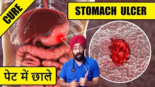 Why your Stomach Ulcer & Gastritis is not healing | Reason to cure | Dr.Education Hindi Eng