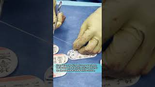 Common Plastic Surgery Sutures