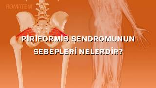 Piriformis Sendromu Romatem | Spor Yaralanmaları, Bel Ağrısı, Bacak Ağrısı, Kalça Ağrısı, Bel Fıtığı