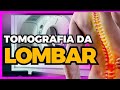 VEJA AGORA COMO É UMA TOMOGRAFIA DE COLUNA #RADIOLOGIA