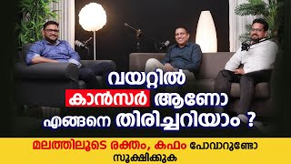 വയറ്റിൽ കാൻസർ ആണോ എങ്ങനെ തിരിച്ചറിയാം ? Cancer Podcast Malayalam | Cancer Malayalam