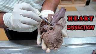 Anatomy Dissection of Heart