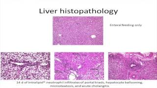 PARENTERAL NUTRITION   H  van Goudoever 10 10 2013