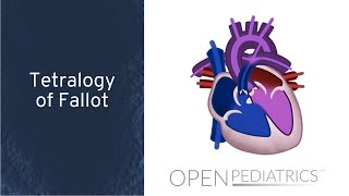 Tetralogy of Fallot by M. Mazwi | OPENPediatrics