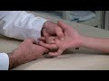 How to Examine the Hand | Merck Manual Professional Version