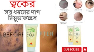 DXN Tea Tree Cream//ত্বকের সকল ধরনের দাগ দূর করুন//